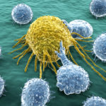 Natural killer cells; looking for cancer cures within the immune system